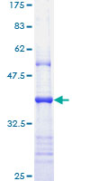 12.5% SDS-PAGE Stained with Coomassie Blue.